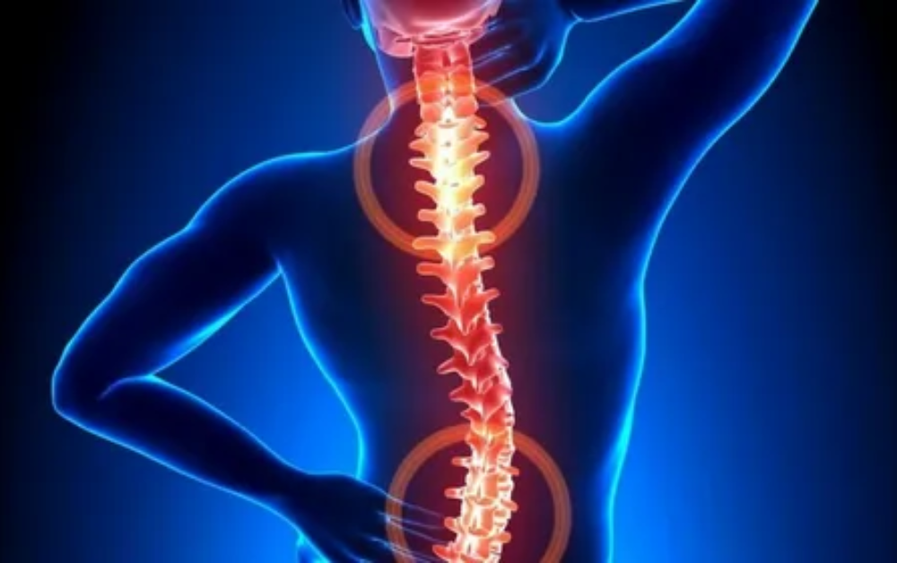 cervical spondylitis
