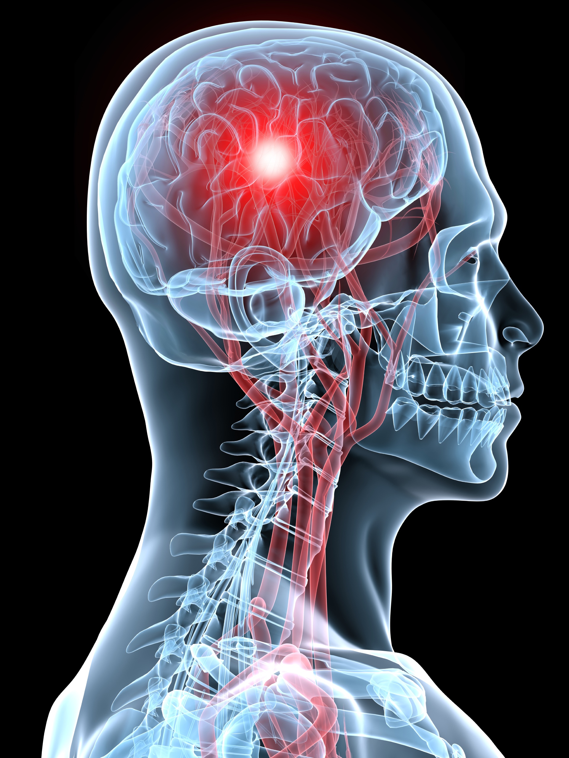 concussion clinic